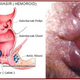 Illustration for article titled obat wasir manjur